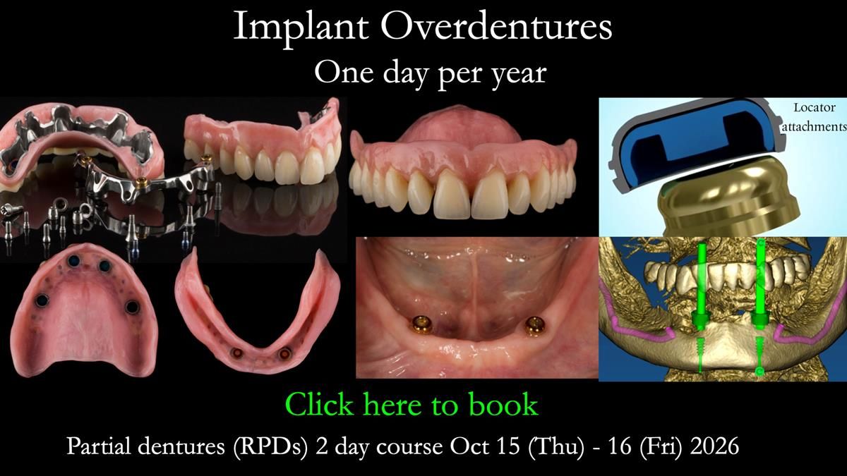 Ken – going downhill, first class