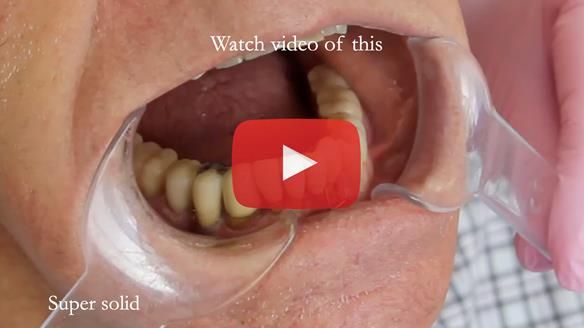 Ken – going downhill, first class