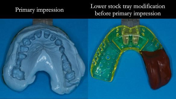 Ken – going downhill, first class