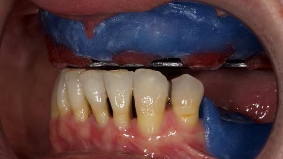 Newsletter 79 – Creating a wonderful smile and changing a life.