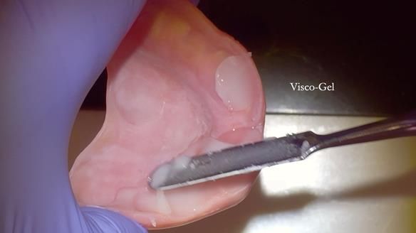 Newsletter 79 – Creating a wonderful smile and changing a life.