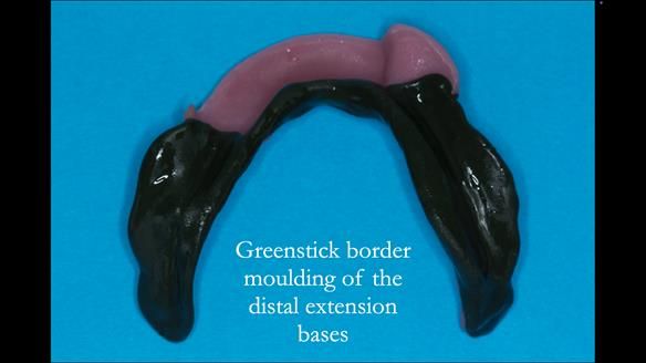 Ken – going downhill, first class