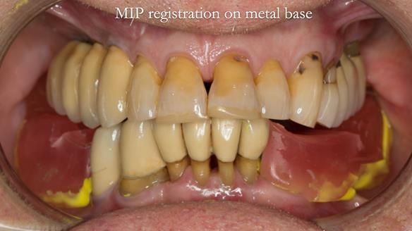 Ken – going downhill, first class