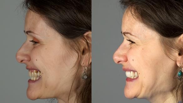 Newsletter 79 – Creating a wonderful smile and changing a life.