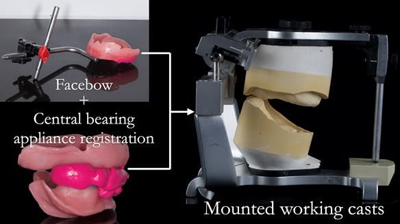 Newsletter 50 Special edition Complete Dentures FULL PROTOCOL