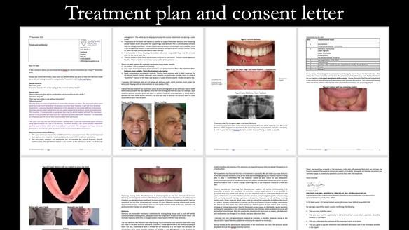 Managing poor implant positioning with complete dentures and Locator attachments - full protocol Newsletter 41