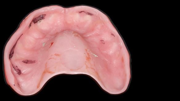 Newsletter 79 – Creating a wonderful smile and changing a life.