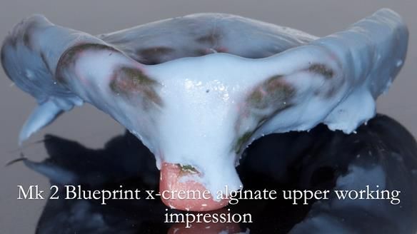 Replacing Madeline’s Complete denture FULL PROTOCOL