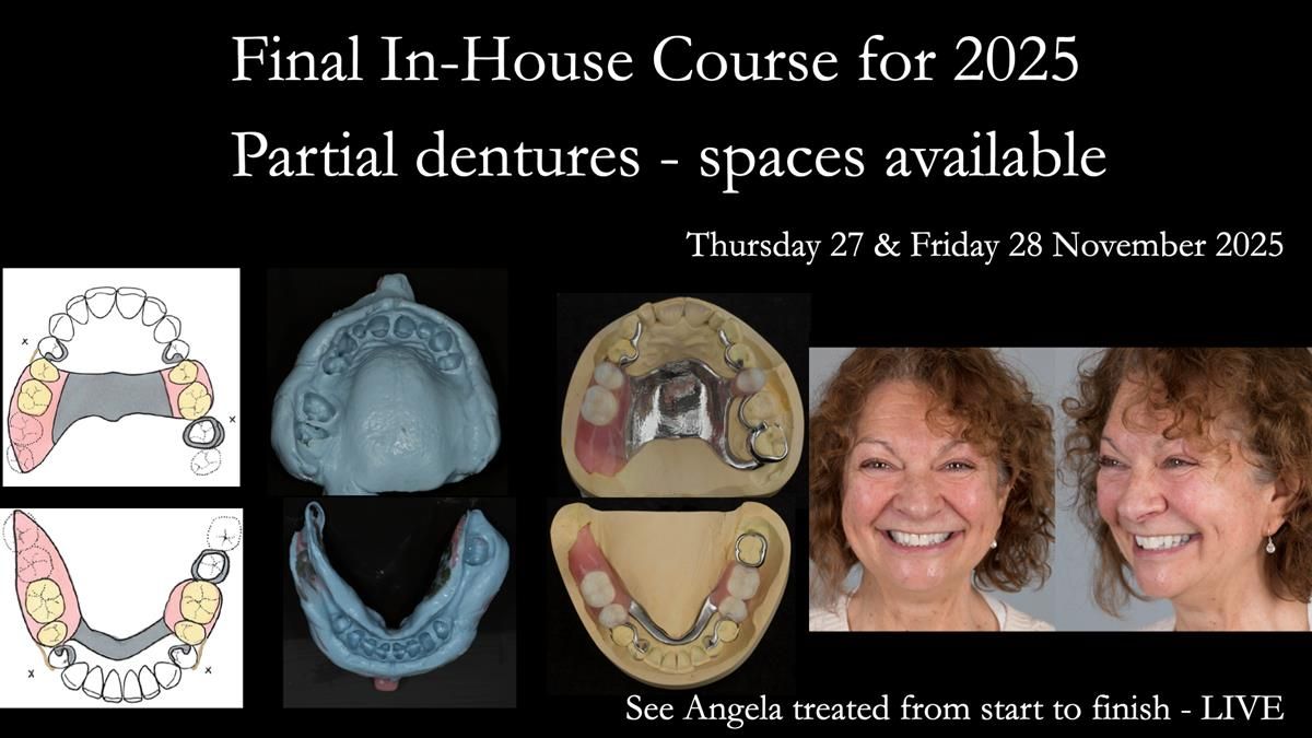 Newsletter 82 Mary - A complete upper and a one-tooth gasket denture