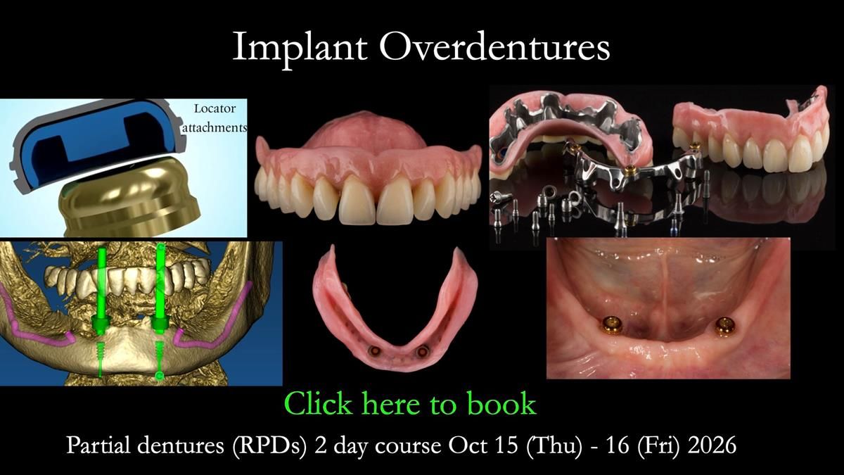 Newsletter 86 Peter the Architect — precision removable partial dentures case study