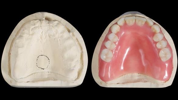 Newsletter 79 – Creating a wonderful smile and changing a life.