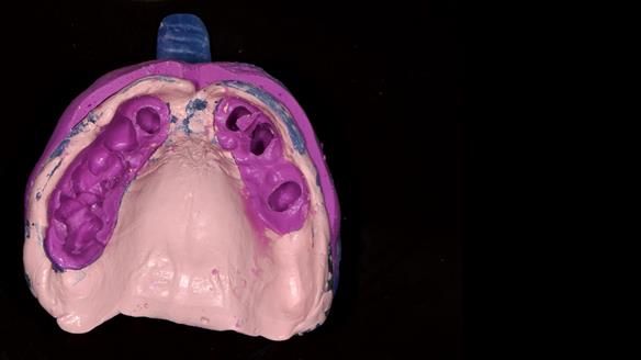 Newsletter 79 – Creating a wonderful smile and changing a life.