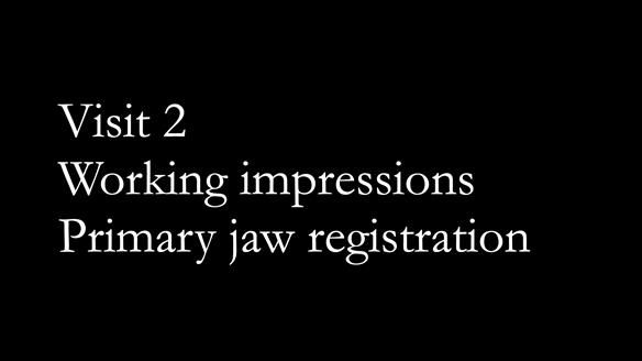 Newsletter 76: Jackie’s case – Telescopic overdenture & precision RPD (the tricky truth!)
