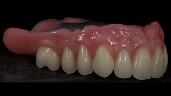 Newsletter 79 – Creating a wonderful smile and changing a life.