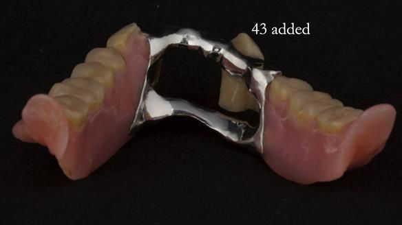 Ken – going downhill, first class