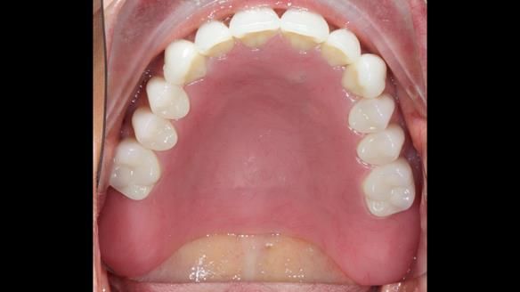 Newsletter 79 – Creating a wonderful smile and changing a life.