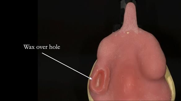 Ken – going downhill, first class