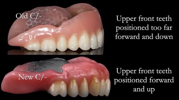 Newsletter 50 Special edition Complete Dentures FULL PROTOCOL