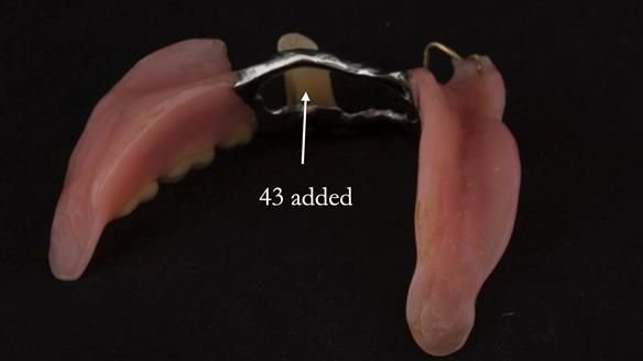 Ken – going downhill, first class