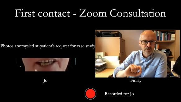 Newsletter 52 Managing Jo’s failing dentition with extractions and Mk 1/Mk 2 complete upper dentures and lower partial dentures FULL PROTOCOL