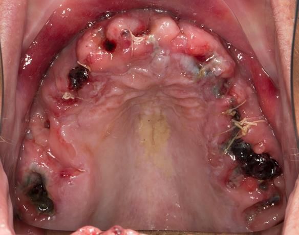 Figure 50 Visit 3 Review 1 post extraction