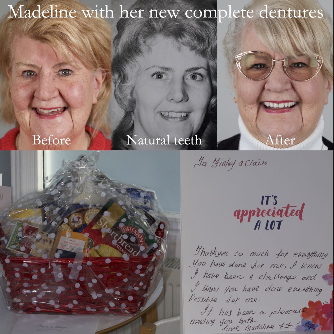 Madeline's new complete dentures