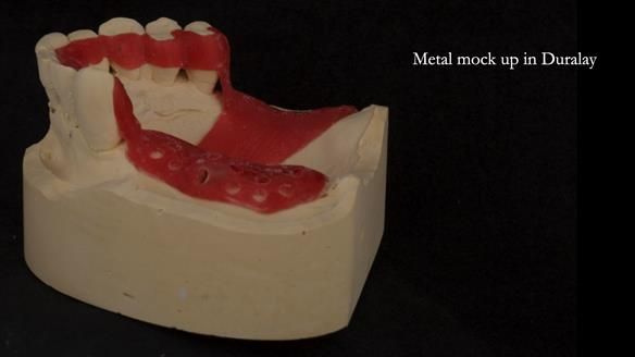 Ken – going downhill, first class