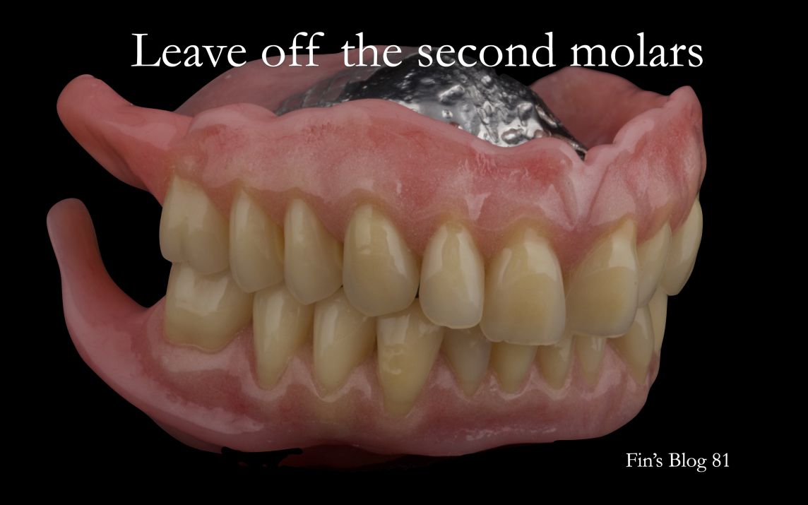 Leave off the second molars for complete dentures