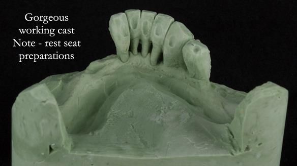 Ken – going downhill, first class