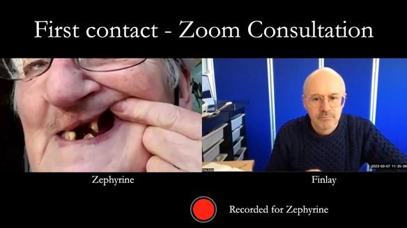 Newsletter 55 Provision of metal based partial dentures for Zephyrine with a repaired cleft lip and palate
