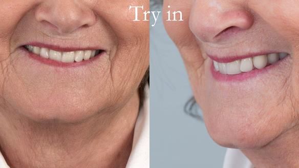 Photos are taken first