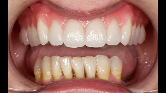 Newsletter 79 – Creating a wonderful smile and changing a life.