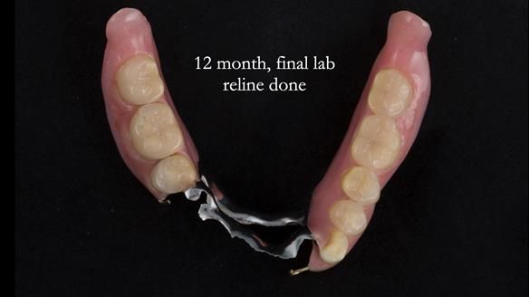 Ken – going downhill, first class