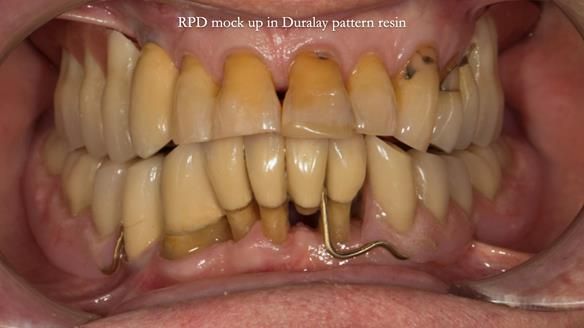 Ken – going downhill, first class