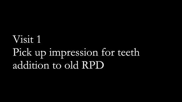 Finlay's Newsletter 62 provision of extractions and metal based complete dentures for Rafique