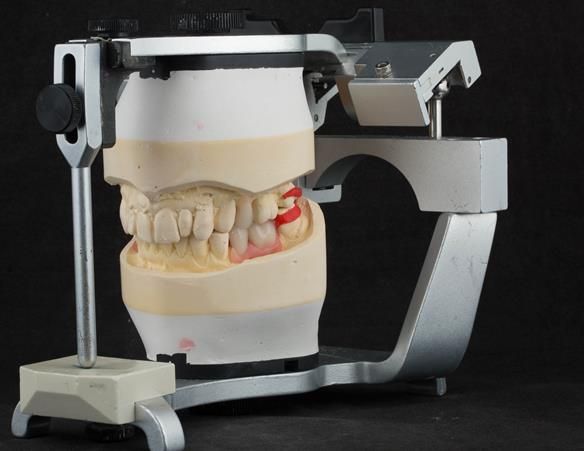 Figure 62 Teeth try in on pattern resin bases. These help to confirm the accuracy of the working casts and the amount of metal work which will be visible in the final dentures