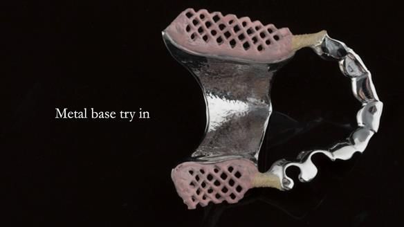 Ken – going downhill, first class