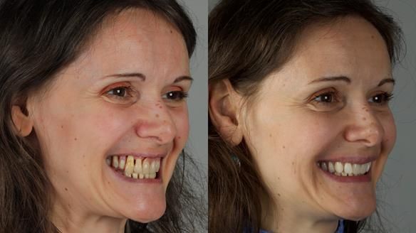 Newsletter 79 – Creating a wonderful smile and changing a life.