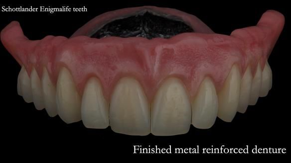 Finished denture