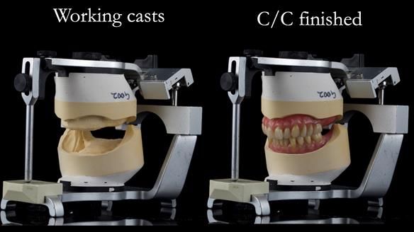 Newsletter 50 Special edition Complete Dentures FULL PROTOCOL