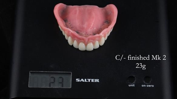 Newsletter 52 Managing Jo’s failing dentition with extractions and Mk 1/Mk 2 complete upper dentures and lower partial dentures FULL PROTOCOL