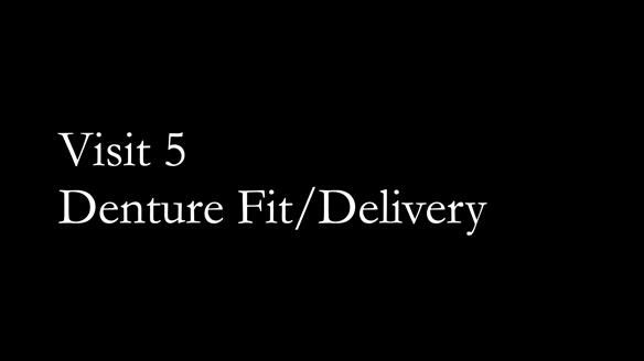 Newsletter 53 showing the making and fitting of ultra life-like dentures for Valena