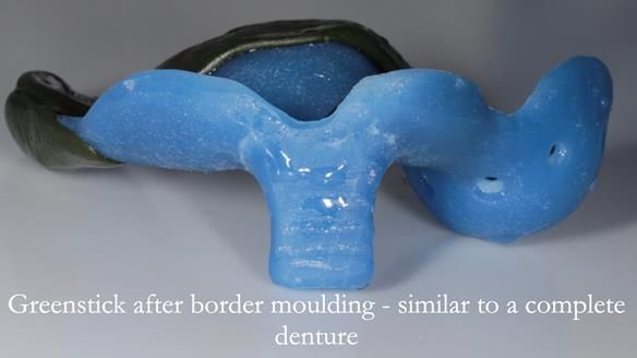 Finlay's Newsletter 58 Gasket upper partial denture for Zoe