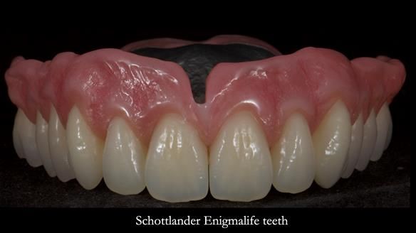 Newsletter 79 – Creating a wonderful smile and changing a life.