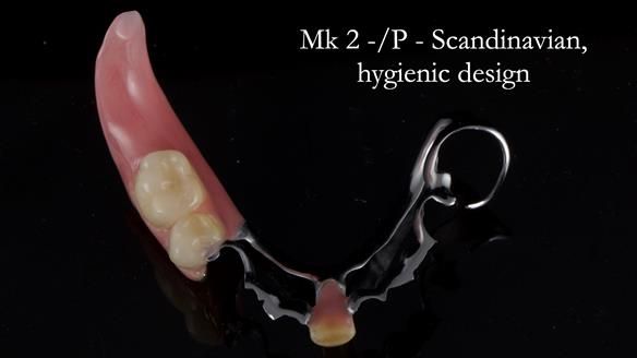 Newsletter 54 case presentation upper complete denture and lower Scandinavian designed hygienic partial denture for David