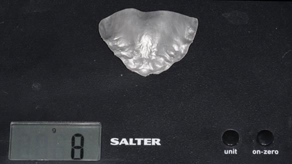 Newsletter 79 – Creating a wonderful smile and changing a life.