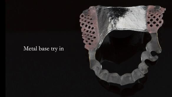 Ken – going downhill, first class