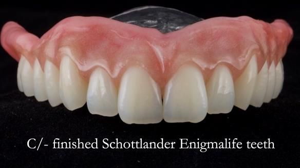 Managing poor implant positioning with complete dentures and Locator attachments - full protocol Newsletter 41