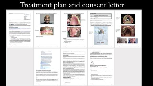 Upper metal base partial denture/occlusal stabilisation splint/obturator - full protocol