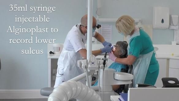 Solving Linda’s Failed “All on 4” implant bridges - full protocol Newsletter 42